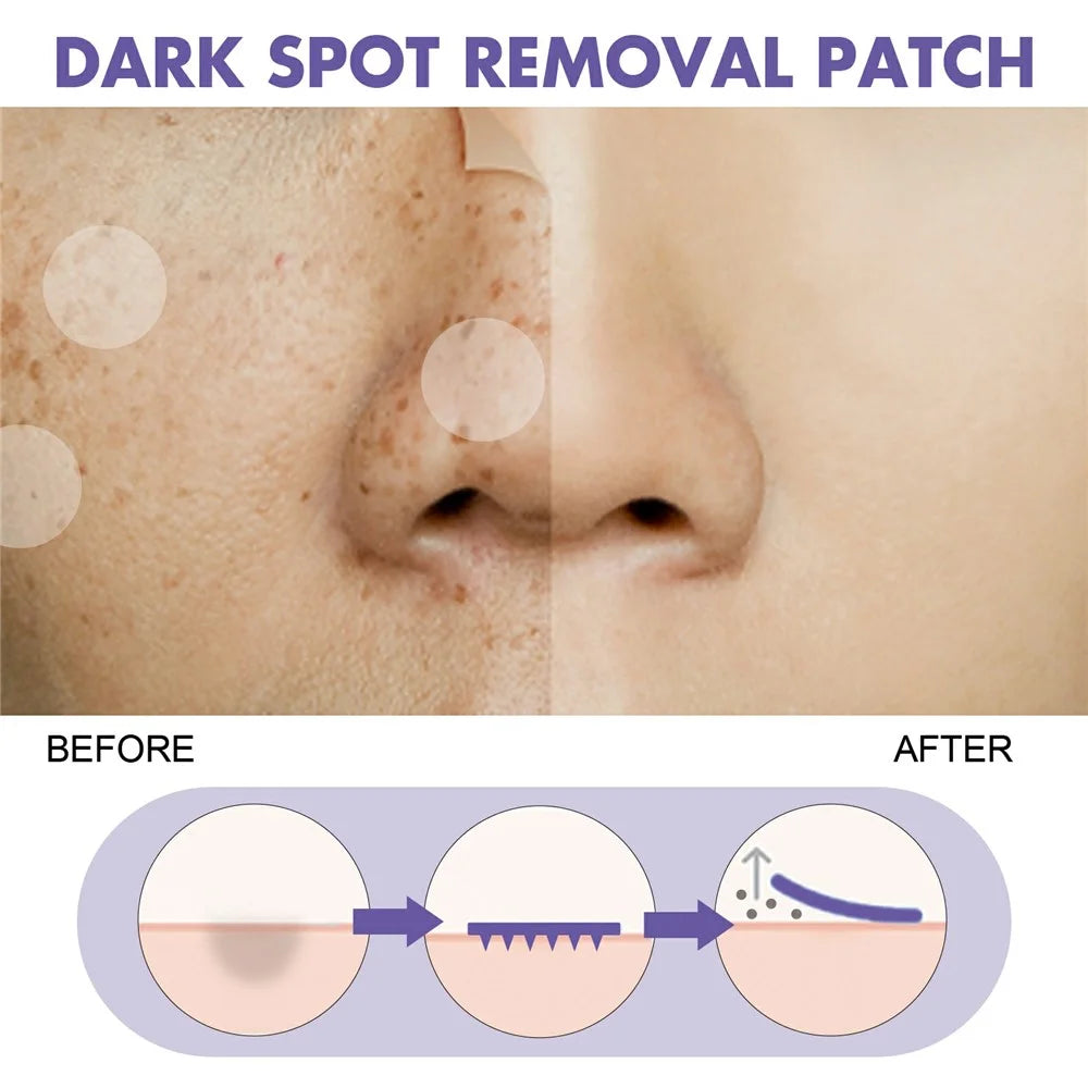 EELHOE 144Pcs Spot Treatment Patches Dark Spot Remover Skin Brightening Stickers, EEA08-A113-144-VT1 - 6