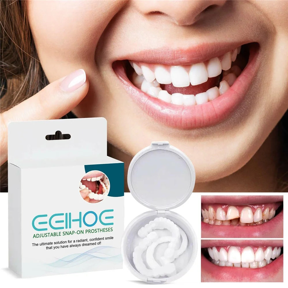EELHOE Adjustable Snap On Veneers Dental Gap Filler Orthodontic Correction Denture Kit, EEA07-A016-1-WH1 - 2
