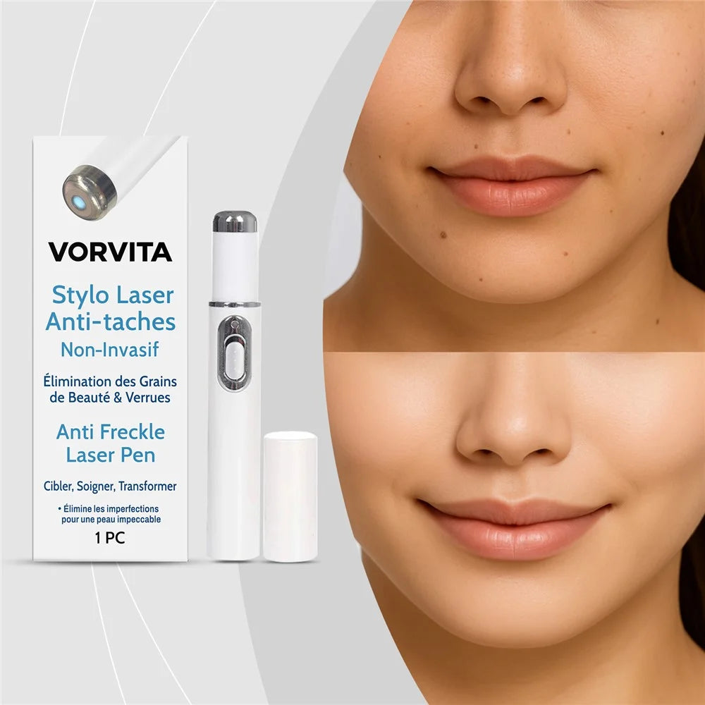 VORVITA Portable Anti Freckle Skin Care Pen Handheld Mole Wart Removal Laser Pen, VO-A08-0002-01 - 2