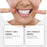 ORALHOE OR-A04-0430-01 Denture Cosmetic Kit Upper / Lower False Teeth for DIY Smile Transformation - 4