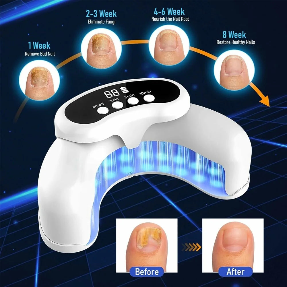 Foldable Fungal Nail Laser Light 30-LED Onychomycosis Repair Toenail Fingernail Care Device, 22 Blue + 8 Red LEDs - 7