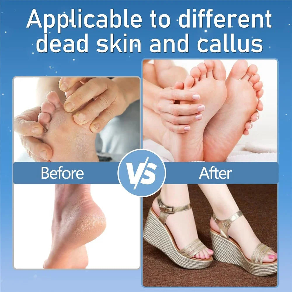 13Pcs Automatic Callus Remover Waterproof Electric Foot File Set for Home - Black - 2
