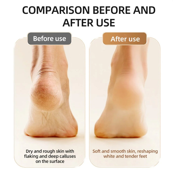 FR12 Mini Electric Foot Callus Remover 9 Speed Settings Dead Skin Remover Pedicure Tool Gift - Champagne - 4