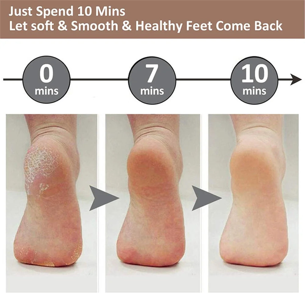 USB Rechargeable Electric Foot File 2 Speed Settings Callus Remover Pedicure Tool for Dead Skin Removal - 3