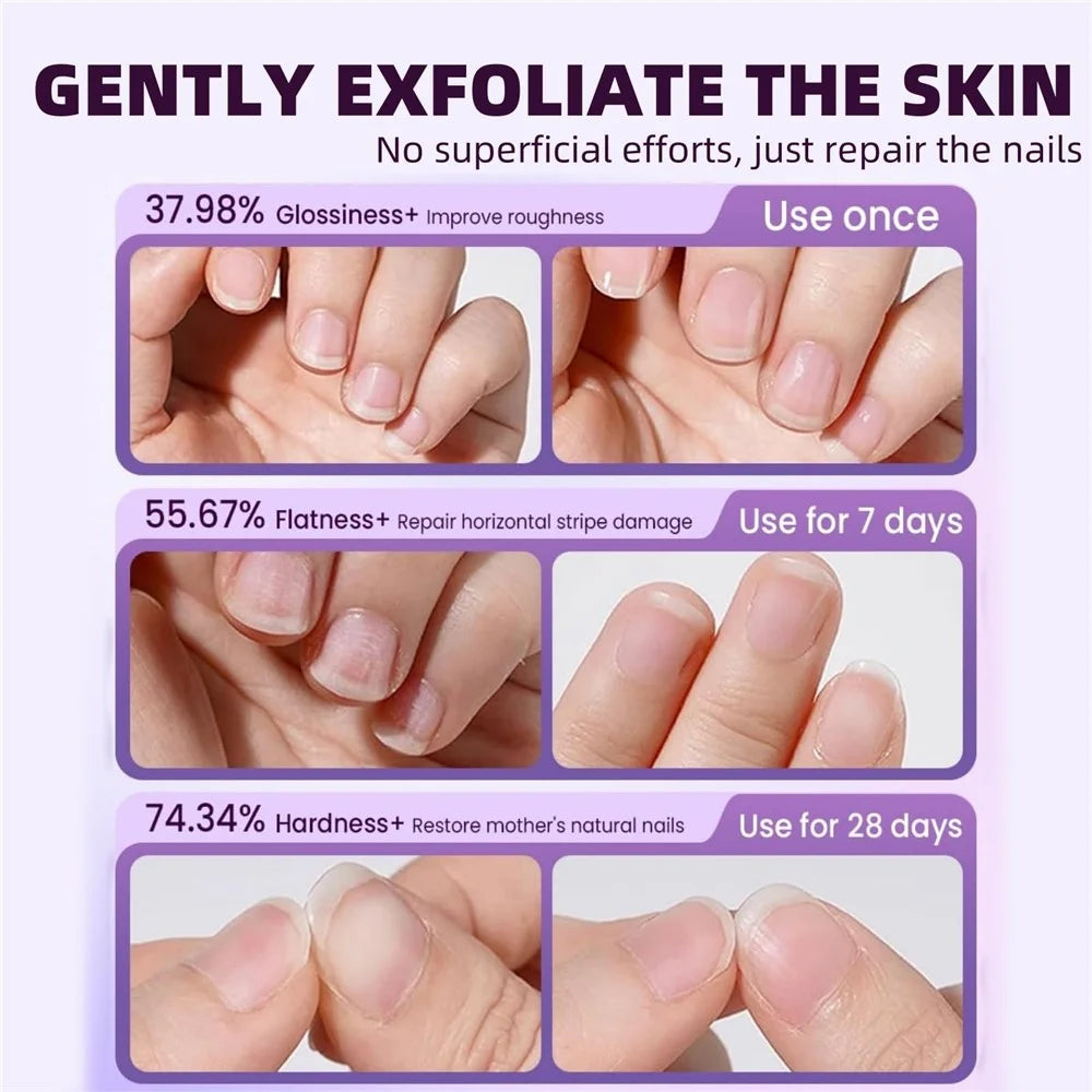 Nail Care Pen Cuticle Remover Hangnail Repair Tool Damaged Nail Treatment File Nourishing Oil for Nail Edge Moisturizing - 6