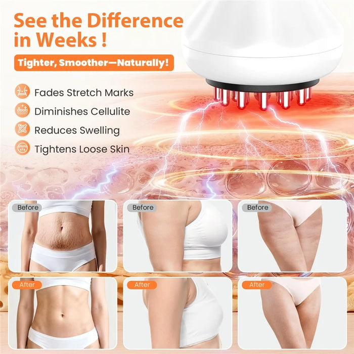 Electric Cordless Massager Bio-Pulse Heat Light Therapy Body Shaping Pain Relief Massager - White - 4