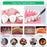 H02077 Plaque Remover Ultrasonic Scaler Tooth Cleaner 5 Modes Rechargeable Teeth Stain Remover Tool - Black - 5