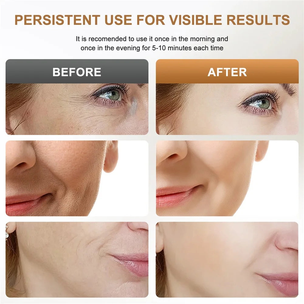 K318 EMS Neck Massager Face Lifting Wrinkle Removal Anti Aging Skin Care Beauty Device Gift - 3