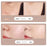 E23 Portable Beauty Equipment Replaceable Needles USB Charging 9 Levels Adjustable Skin Nevus Tag Removal Kit Tools for Home Usage - Gold - 4