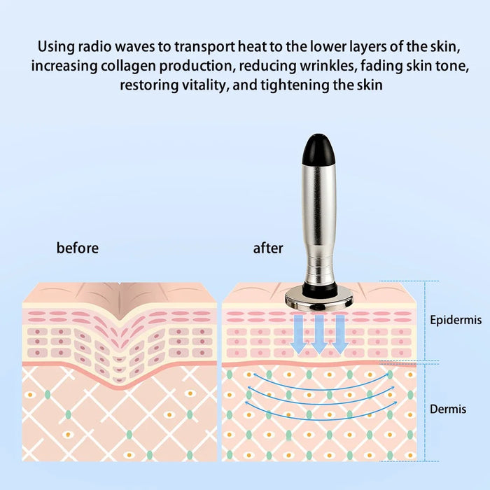 SP-121 Bipolar RF and EMS Skin Tightening Facial Radio Frequency Machine Gift Face Lift Body Shaping Massager, CE Certified (ST) - EU Plug - 3
