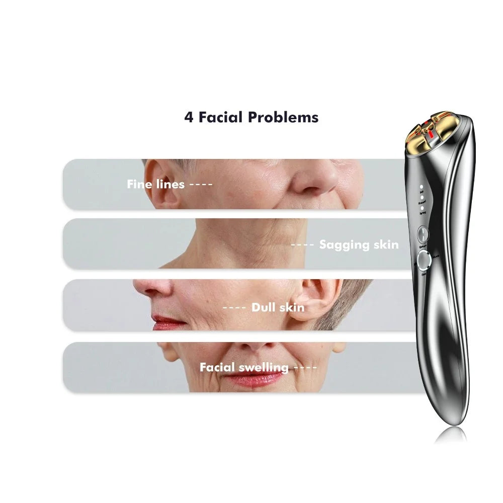 HQ-B009 RF Beauty Instrument Radiofrequency Photon EMS Facial Massager - 3