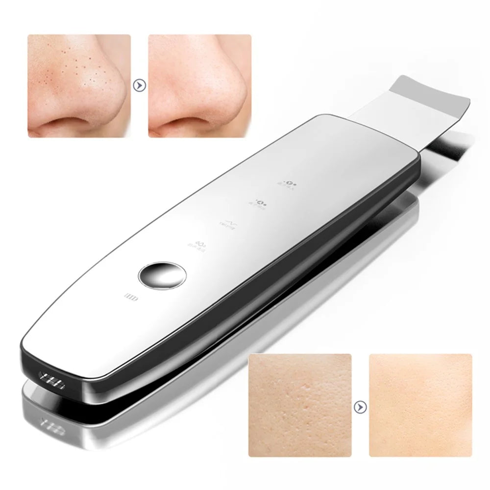 M22 Ultrasonic Skin Scrubber Face Spatula Pore Cleaner Blackhead Remover Tool - 2