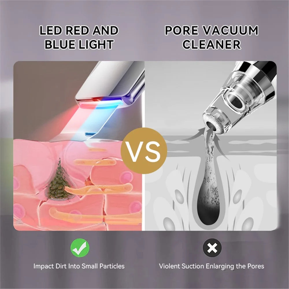 M22 Ultrasonic Skin Scrubber Face Spatula Pore Cleaner Blackhead Remover Tool - 5
