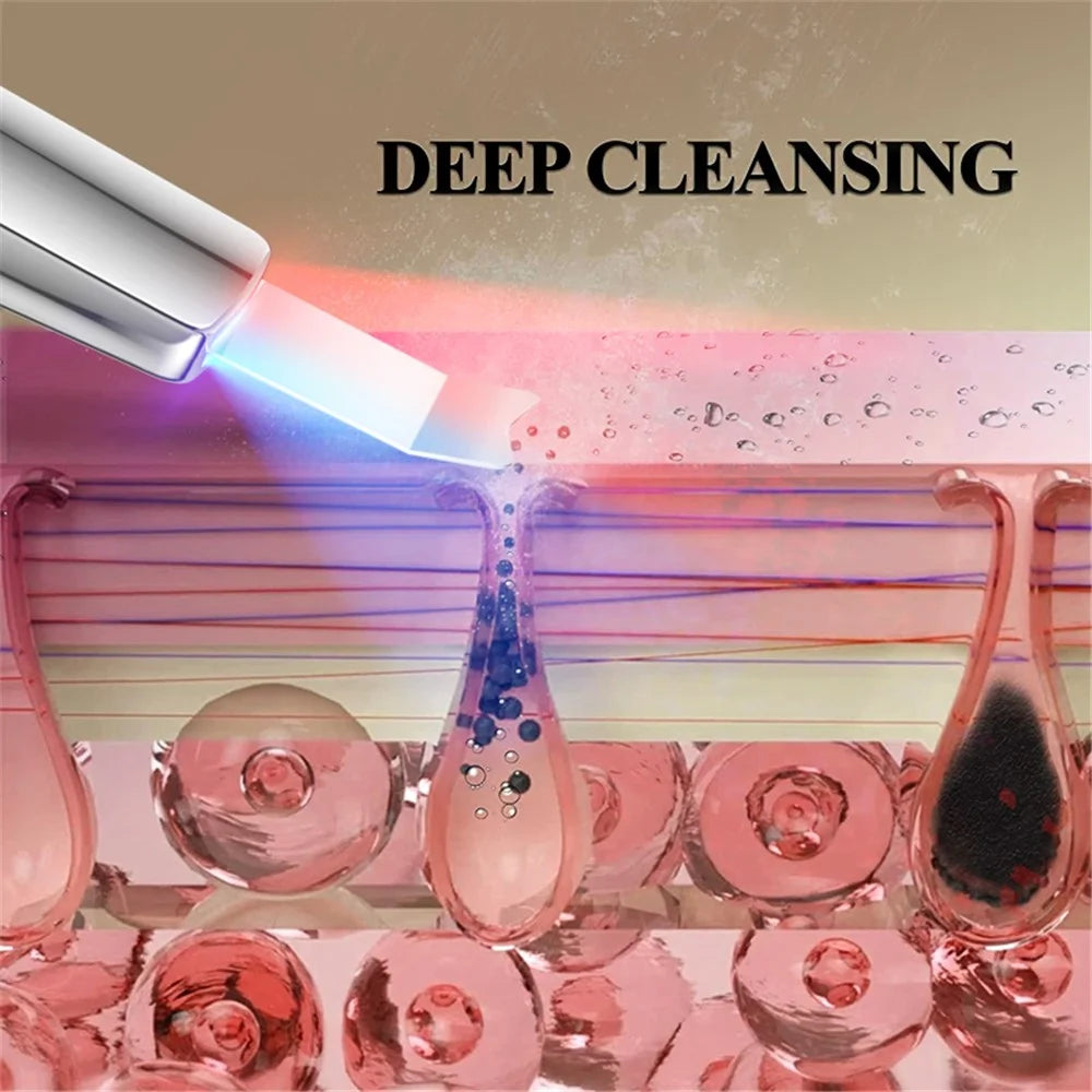 M22 Ultrasonic Skin Scrubber Face Spatula Pore Cleaner Blackhead Remover Tool - 6