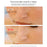 RF Face Lifting Machine EMS Pulse Therapy Device Skin Rejuvenation Micro Current Wrinkle Remover - Champagne - 4