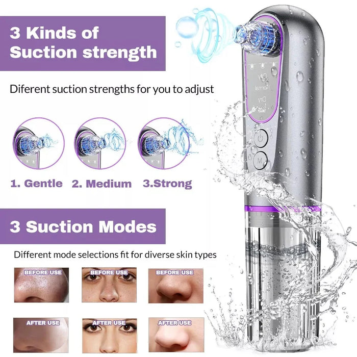 YC155 Blackhead Remover Vacuum Suction Device Pore Cleaner with Bubble Technology For Home Use - 6