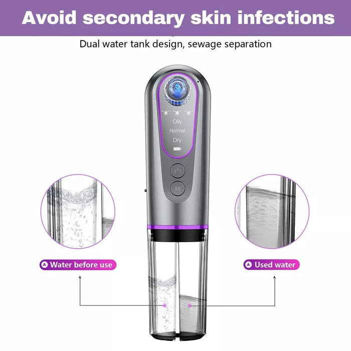 YC155 Blackhead Remover Vacuum Suction Device Pore Cleaner with Bubble Technology For Home Use - 7