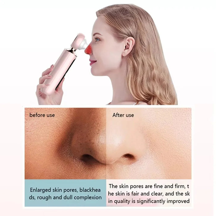 2061 Visual Blackhead Remover USB Rechargeable Face Pore Cleaner with 3 Suction Heads - 7