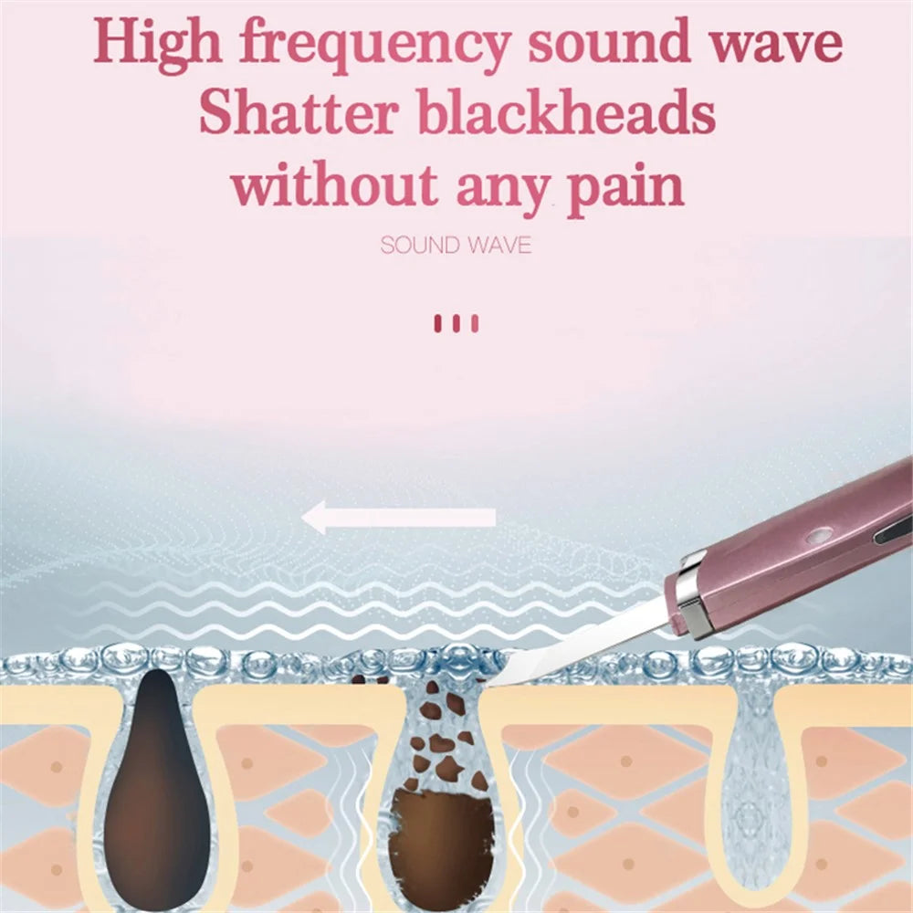 CS-3 Ultrasonic Facial Cleanser Blackhead Remover Facial Spatula Pore Cleaning Beauty Device Gift - 4