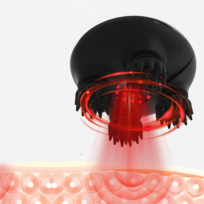 YESIDO MG04 Handheld Electric EMS Scalp Massager Portable Head Massager with 3 Gear Head Scratcher for Stress Relax and Pain Relief - 4