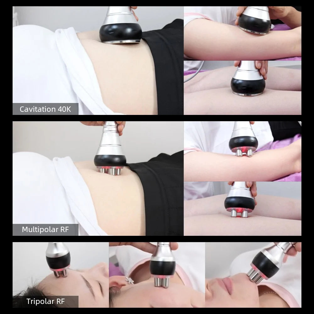 40K Cavitation Ultrasonic Weight Loss Beauty Machine RF Radio Frequency Skin Lifting Device, CE Certified (ST) - EU Plug - 4