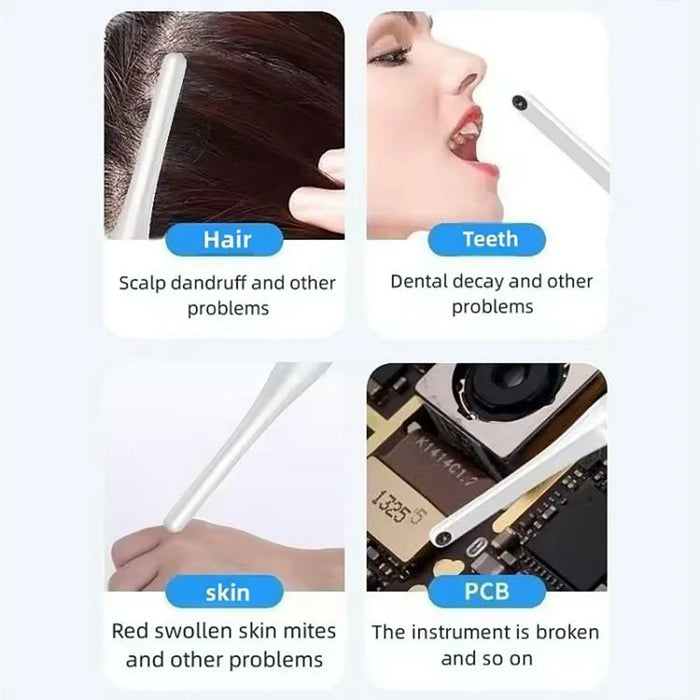 HD WiFi Dental Camera Intraoral Endoscope with LED Light Oral Care Cleaning Inspection Tool - White - 5