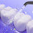 XY-12 Portable Mini Teeth Cleaner IPX7 Waterproof Oral Irrigator Electronic Dental Scaler with 2 Modes - White - 5