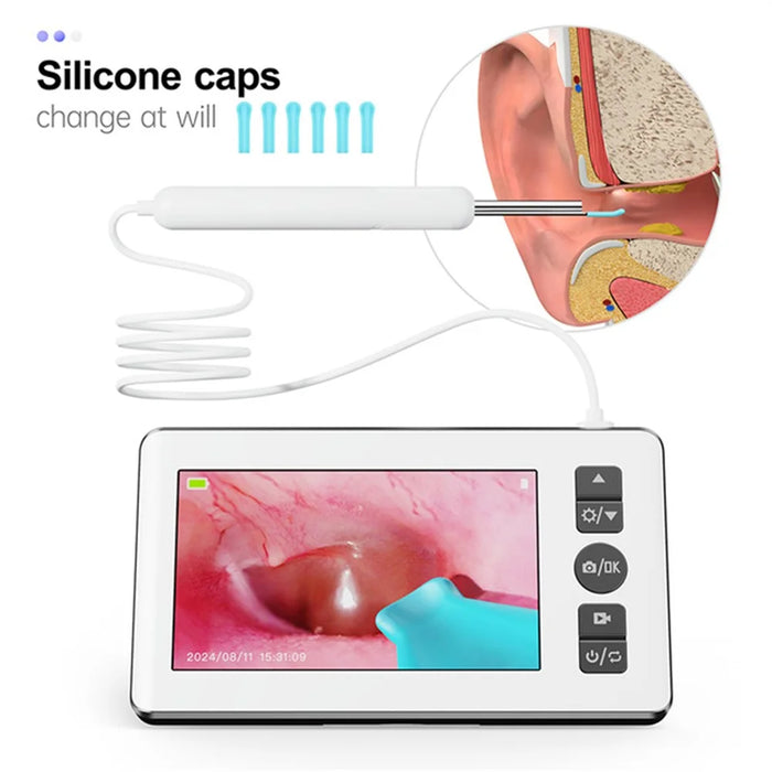 N18 HD Visual Ear Cleaning Endoscope Professional 4.3 Inch Screen Otoscope Ear Wax Removal Tool - 2