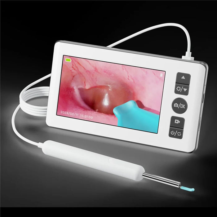 N18 HD Visual Ear Cleaning Endoscope Professional 4.3 Inch Screen Otoscope Ear Wax Removal Tool - 7