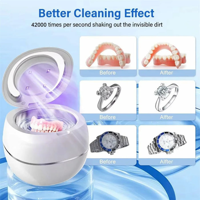 Ultrasonic Retainer Cleaner Machine 43khz Cleaning Pod with 2 Cleaning Modes Digital Timer for Mouth Guard, Jewelry, EU Plug - White - 4