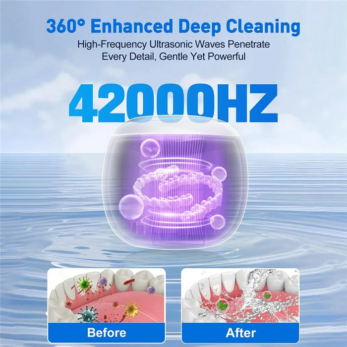 Ultrasonic Retainer Cleaner Machine 43khz Cleaning Pod with 2 Cleaning Modes Digital Timer for Mouth Guard, Jewelry, EU Plug - White - 5