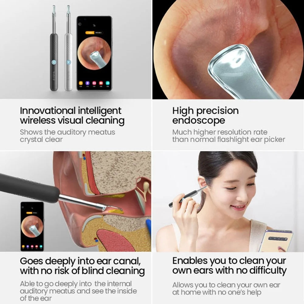 XIAOMIYOUPIN Bebird R1 Intelligent Visual Ear Sticks Endoscope 300W High Precision Earpick In-Ear Mini Camera Otoscope Ear Cleaner (Chinese Version) - Black - 5