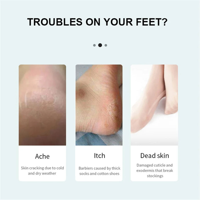 MJQ03 Electric Foot Callus Remover Foot Grinder Rechargeable Pedicure Tool Gift with 3 Roller Heads - 5