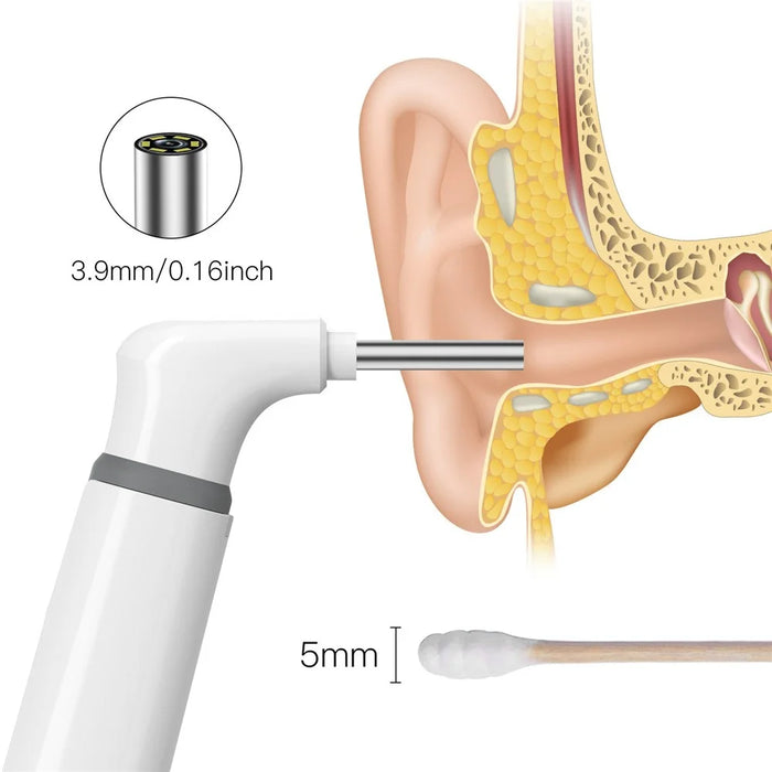 TESLONG SA39W 3.9mm WiFi Visual Otoscope Ear Endoscope Camera Ear Wax Cleaner Camera - 6