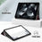 For iPad (2025) / 10.9 (2022) Pattern Printed Protective Case PU Leather Anti-Drop Auto Wake / Sleep Tablet Cover with Trifold Stand - Starry Sky - 4
