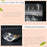 MX-009 100Pcs 22x32cm+5cm Reusable Zipper Lock Bag 16C Aluminium Foil Stand Up Pouches - 4