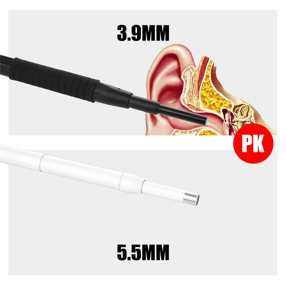 AN103 3-in-1 3.9mm Otoscope Camera Ear Scope Endoscope Ear Wax Removal Tool - Black - 2