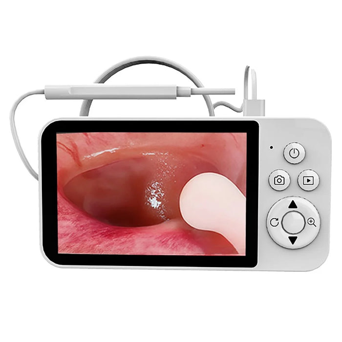 Y40 4.3 inch Screen Visual Otoscope Endoscope High Definition Visualization Ear Cleaning Endoscope - 1
