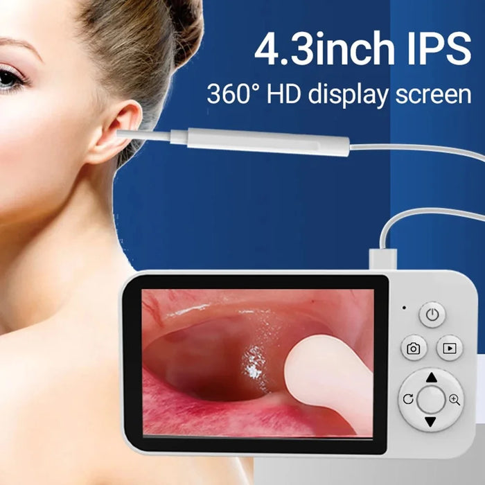 Y40 4.3 inch Screen Visual Otoscope Endoscope High Definition Visualization Ear Cleaning Endoscope - 2