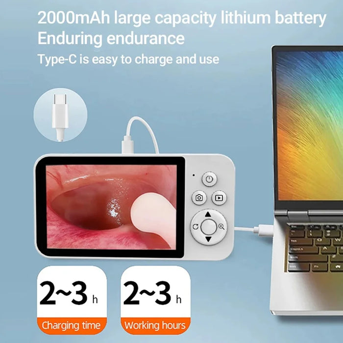 Y40 4.3 inch Screen Visual Otoscope Endoscope High Definition Visualization Ear Cleaning Endoscope - 4