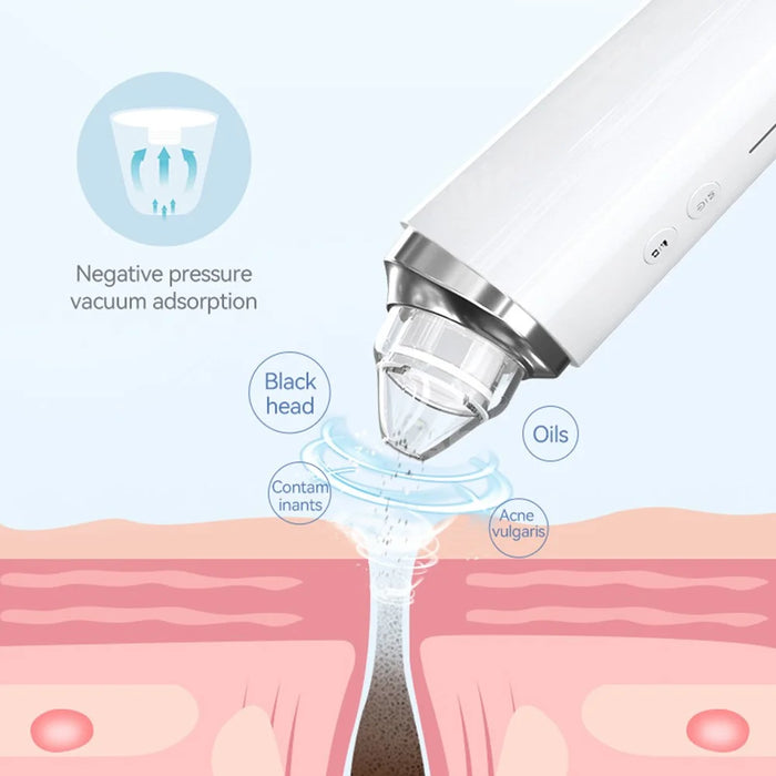 H200 Visual Blackhead Remover 20X Magnification Vacuum Suction Device Face Pore Cleaner with 6 Suction Heads - Pink - 4