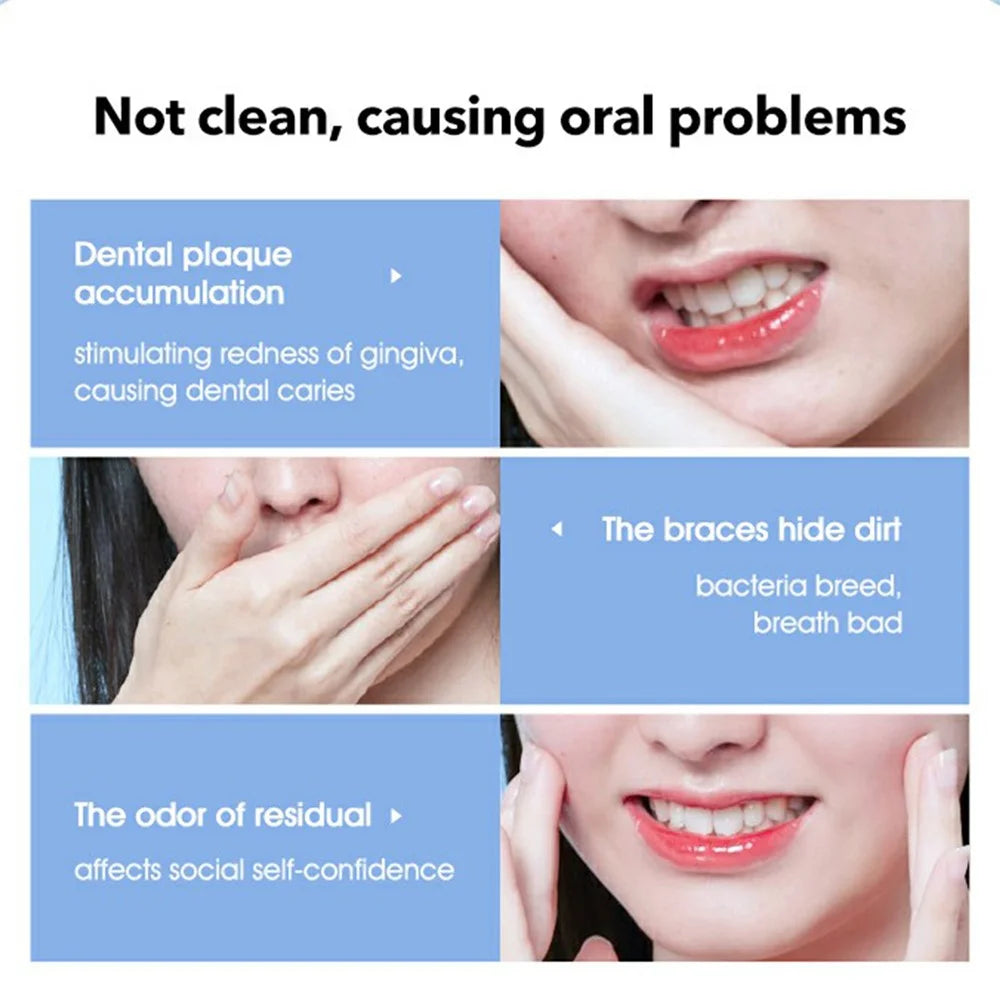 XIAOMIYOUPIN SOOCAS W3 Pro Portable Teeth Cleaner Oral Irrigator Rechargeable Waterproof Toothpick Oral Cleaning Tooth Whitening 360-degree Rotary Nozzle (Chinese Version) - 3