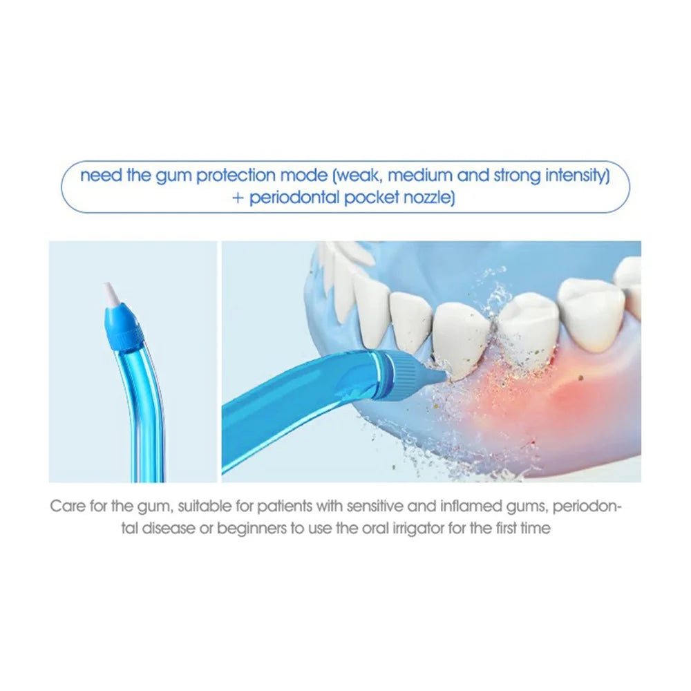 XIAOMIYOUPIN SOOCAS W3 Pro Portable Teeth Cleaner Oral Irrigator Rechargeable Waterproof Toothpick Oral Cleaning Tooth Whitening 360-degree Rotary Nozzle (Chinese Version) - 7