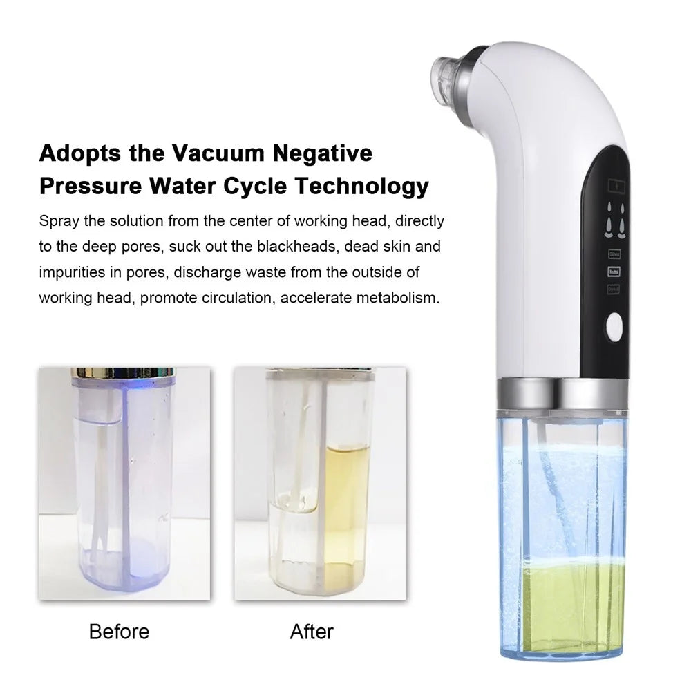 Electric Small Bubble Blackhead Remover USB Rechargeable Strong Suction Vacuum Suction Water Cycle Pore Cleaner Acne Pimple Black Head Extractor - 7